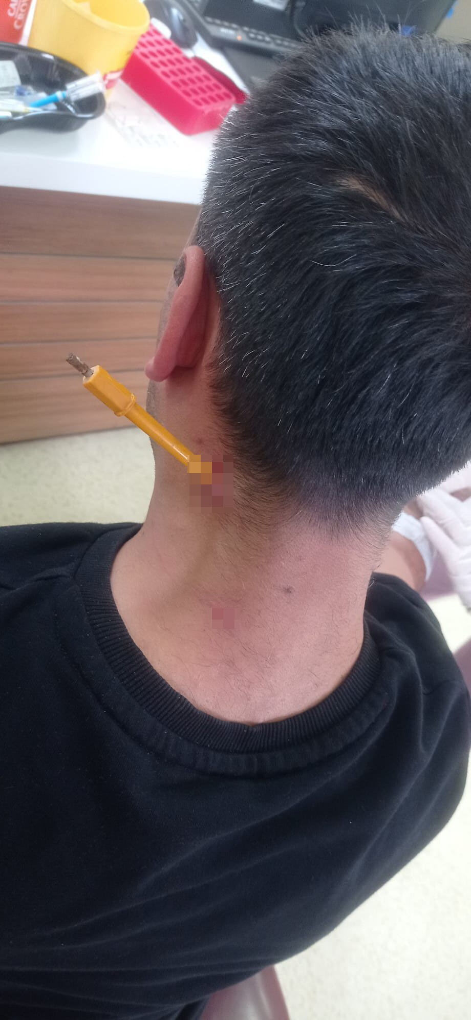 Park yeri kavgasında feci olay! Boynuna tornavida saplandı Park yeri kavgasında feci olay! Boynuna tornavida saplandı - 3. Resim