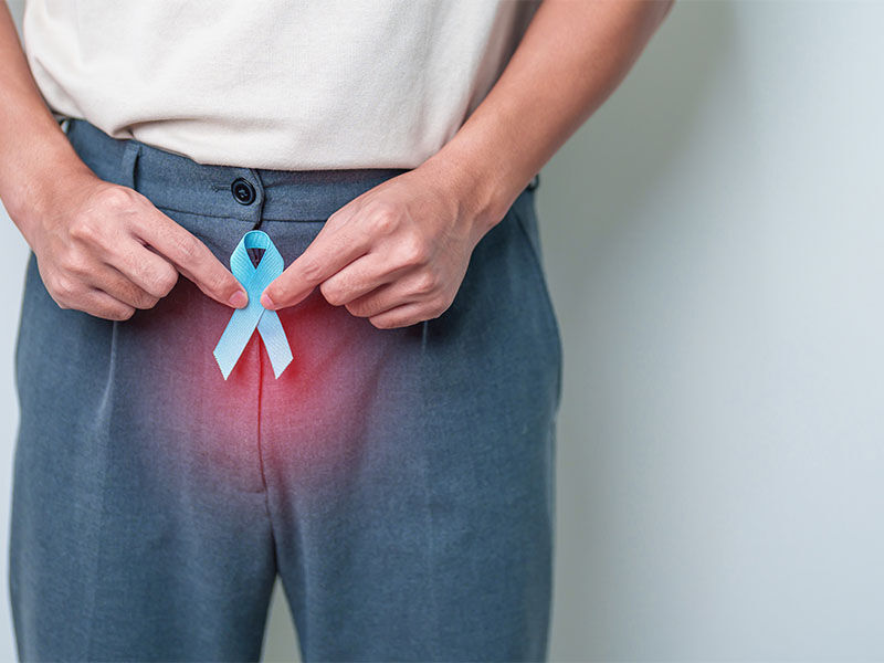 Prostat kanseri belirtileri ve tanısı için dikkat: Sinsi olarak ilerliyor Prostat kanseri belirtileri ve tanısı: Sinsi olarak ilerliyor - 4. Resim