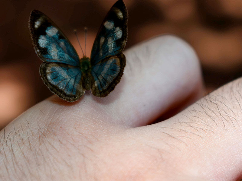 Kelebek hastalığı nedir ve belirtileri nelerdir? Kelebek hastalığı nedir ve belirtileri nelerdir? - 4. Resim