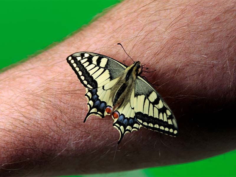 Kelebek hastalığı nedir ve belirtileri nelerdir? Kelebek hastalığı nedir ve belirtileri nelerdir? - 3. Resim