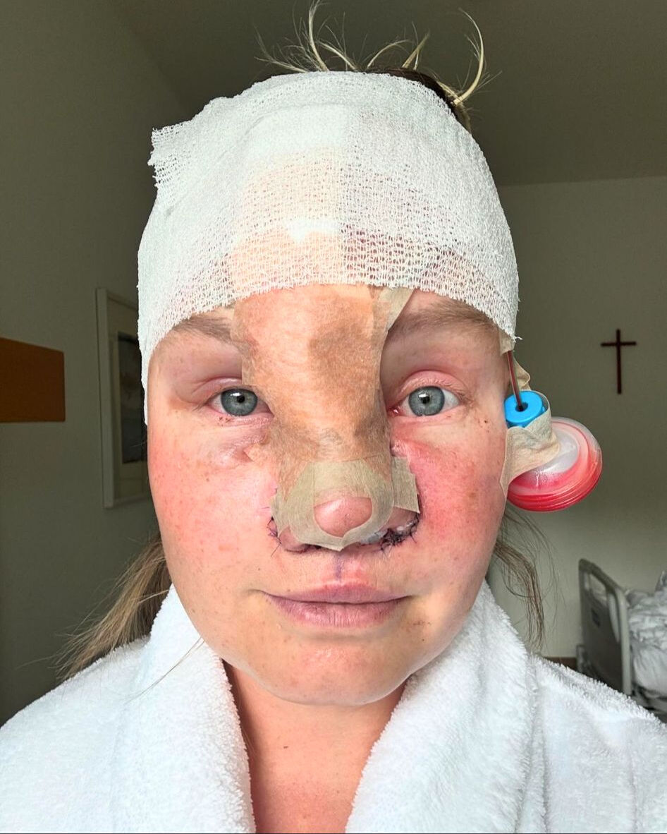 Genç kadına köpek saldırısı! Yüzünü ısırdı, burnunu kopardı - 2. Resim