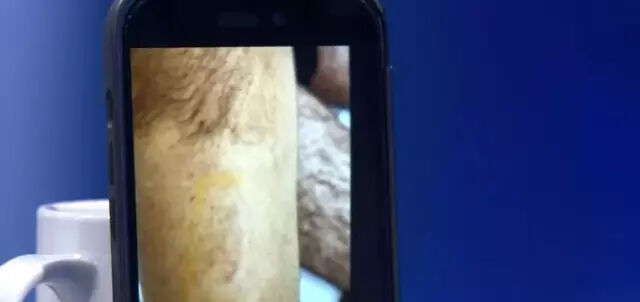 Narin Güran cinayetinde kritik gelişme! Enes Güran'ın kolundaki ısırık ve gözündeki darp izleri ilk kez yayınlandı Narin Güran cinayetinde kritik gelişme! Enes Güran'ın kolundaki ısırık ve gözündeki darp izleri ilk kez yayınlandı - 3. Resim