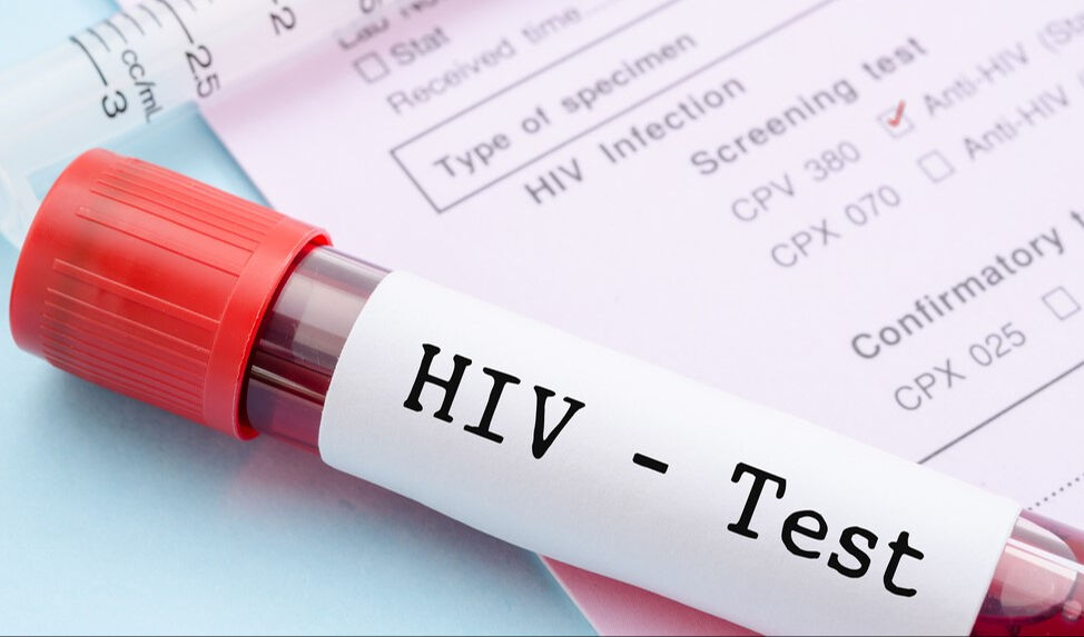 AIDS nedeniyle can veren çocuğun babası da pozitif çıkmıştı! İfadesi ortaya çıktı - 1. Resim