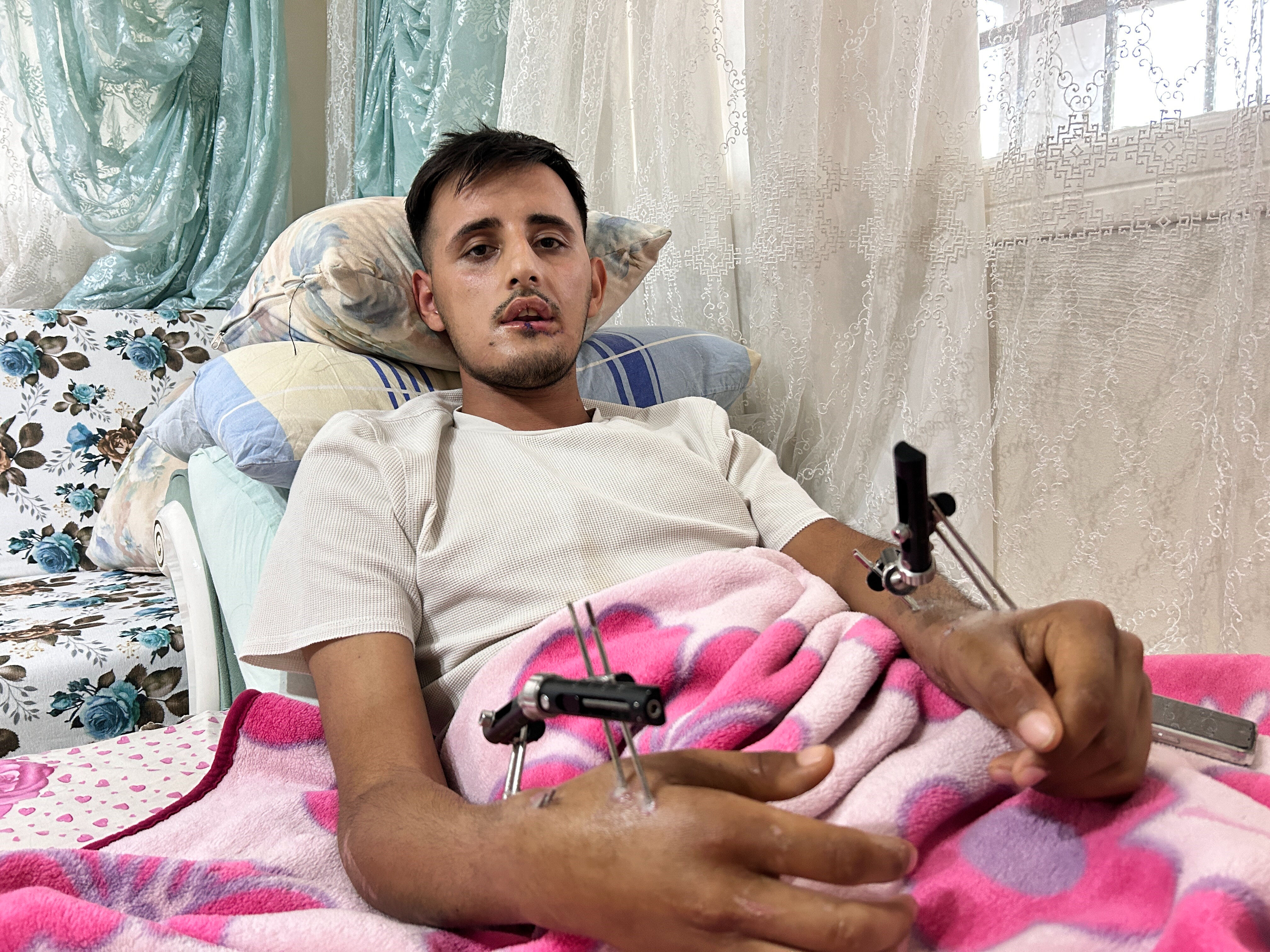 Düğününe 1 hafta kala feci olay! Hataylı gencin hayalleri yarıda kaldı - 4. Resim