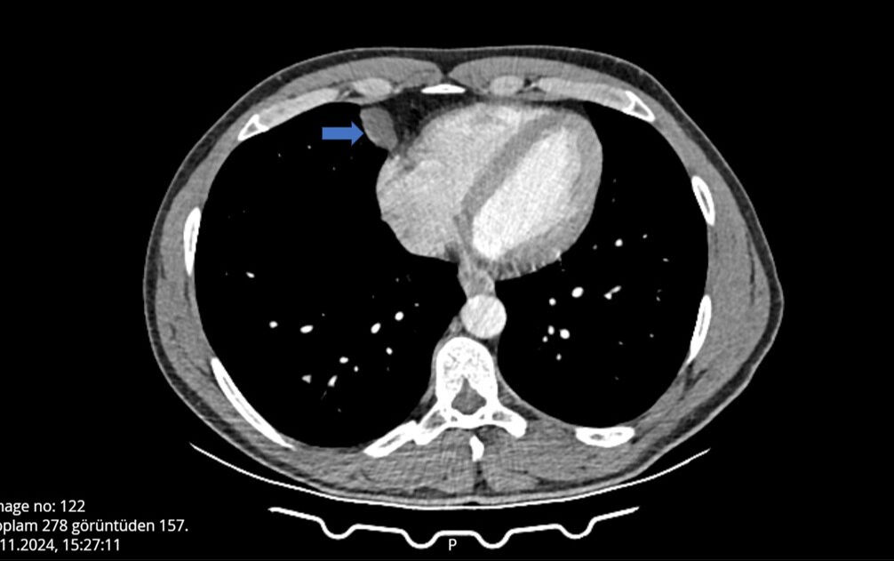Öksürük ve hapşırık kriziyle hastaneye koştu! Gerçeği öğrenince şoke oldu - 1. Resim