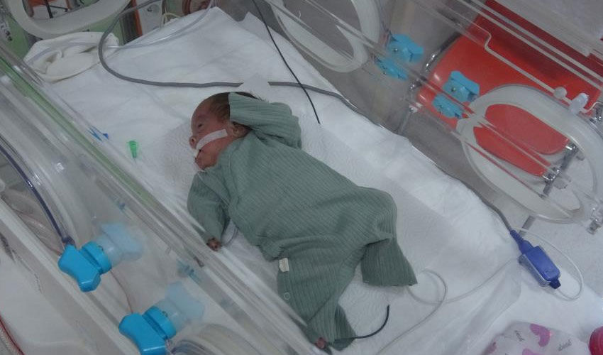 İkizini kaybeden Ada bebeğin hikayesi… Kritik süreci atlattı - 1. Resim