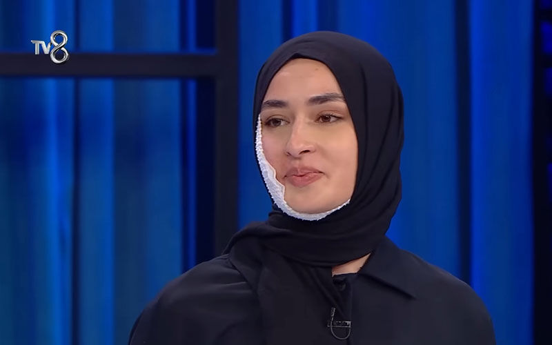 MasterChef Beyza’nın kazasında ‘kurgu’ şüphesi! İzleyicilerin gözünden kaçmadı, tepki üstüne tepki… - 4. Resim