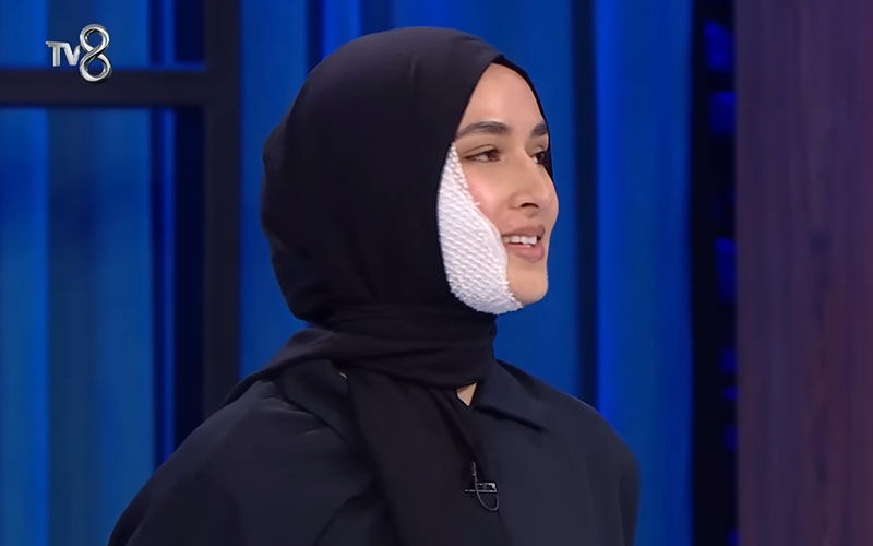 MasterChef Beyza’nın kazasında ‘kurgu’ şüphesi! İzleyicilerin gözünden kaçmadı, tepki üstüne tepki… - 3. Resim