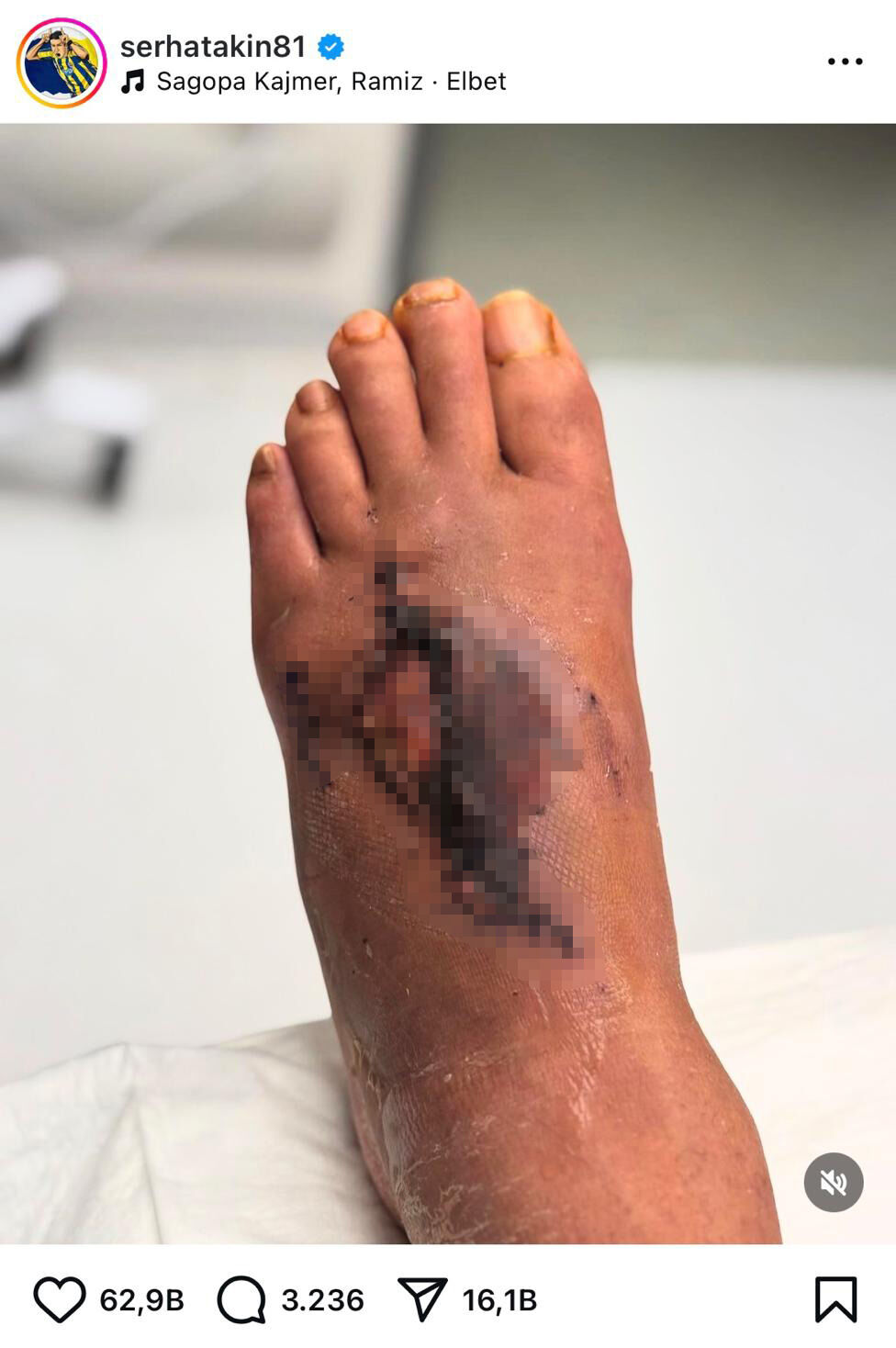 Serhat Akın'dan Acun Ilıcalı'ya zehir zemberek sözler! 