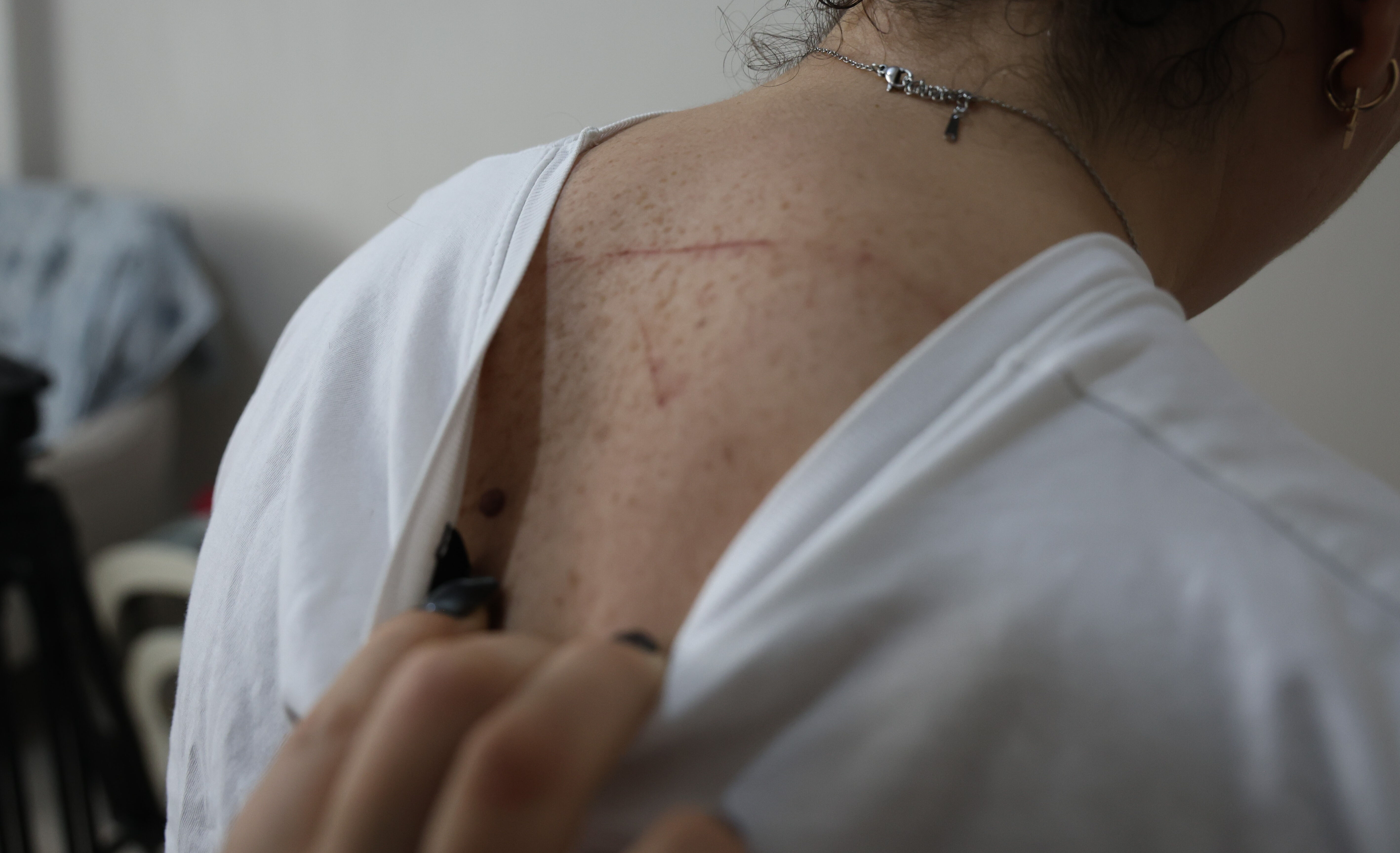 İzmir'de ev sahibi dehşeti! Kiracı çift çivili sopalarla darp edildi - 1. Resim