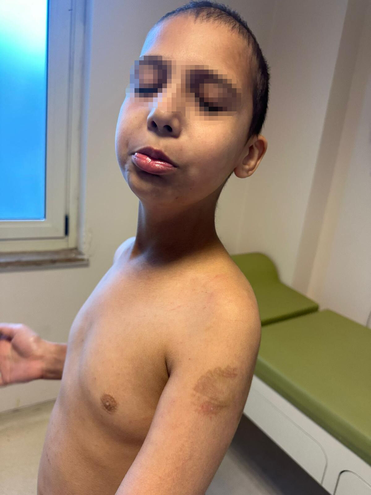 Otizmli çocuğa yapmadıkları kalmadı! Bakımevi değil dehşet evi - 3. Resim