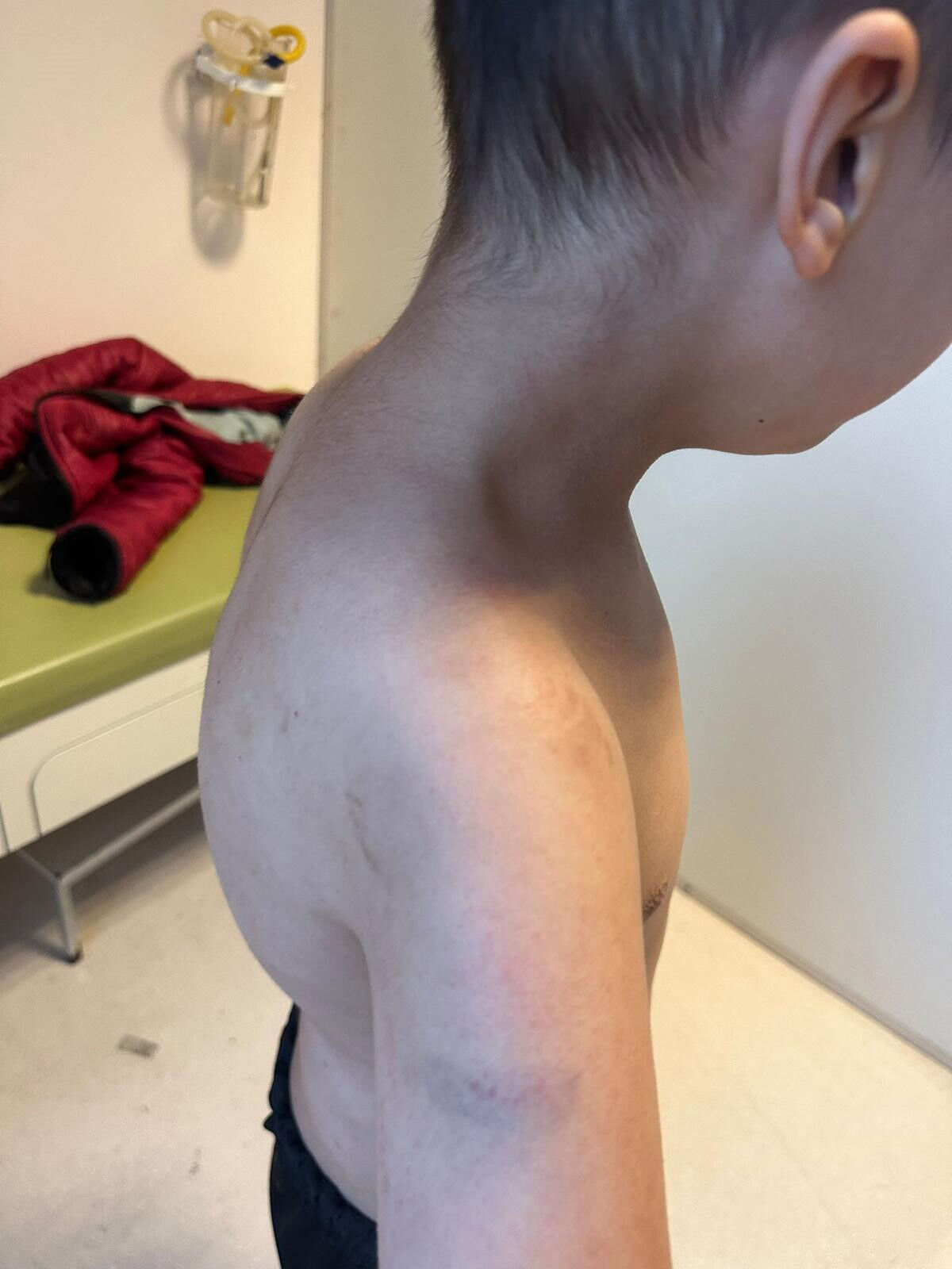 Otizmli çocuğa yapmadıkları kalmadı! Bakımevi değil dehşet evi - 2. Resim