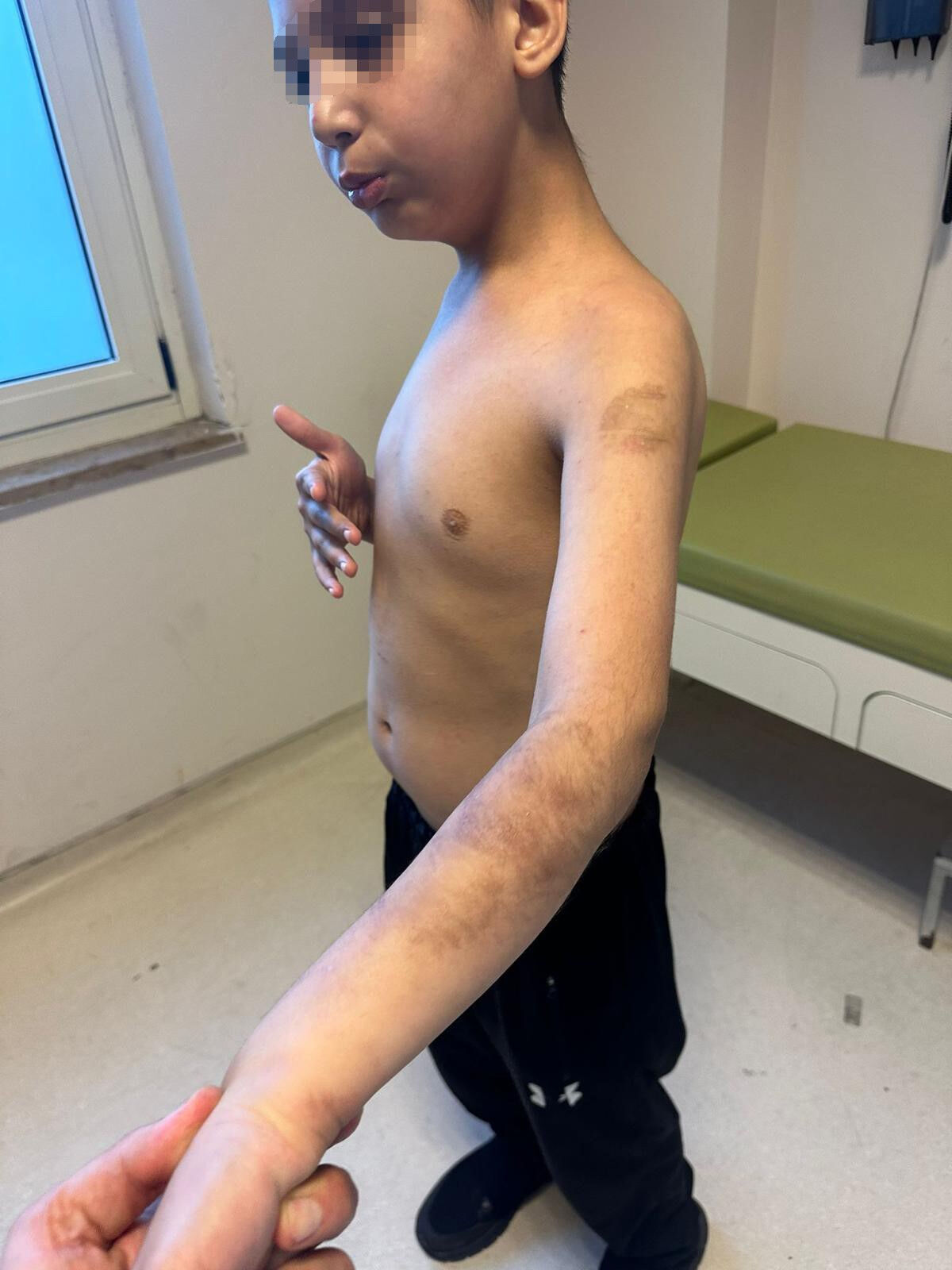 Otizmli çocuğa yapmadıkları kalmadı! Bakımevi değil dehşet evi - 1. Resim