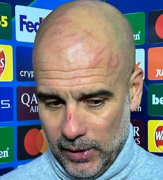 Feyenoord ile 3-3 beraber kalan Manchester City'nin hocası Guardiola sinir krizi geçirdi - 3. Resim