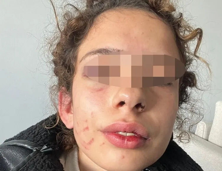 Üniversiteli kız hayatının şokunu yaşadı! 'Sana bir sürprizim var' diyerek geldi, sabah kadar... - 7. Resim