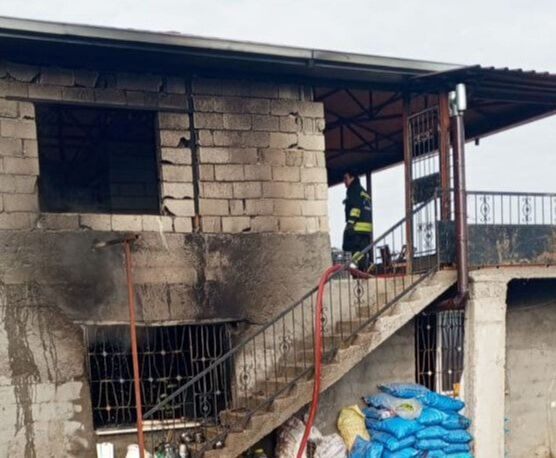 Küçük Abidin'den 5 gün sonra acı haber: Yangın sonrası yaşam savaşını kaybetti - 1. Resim