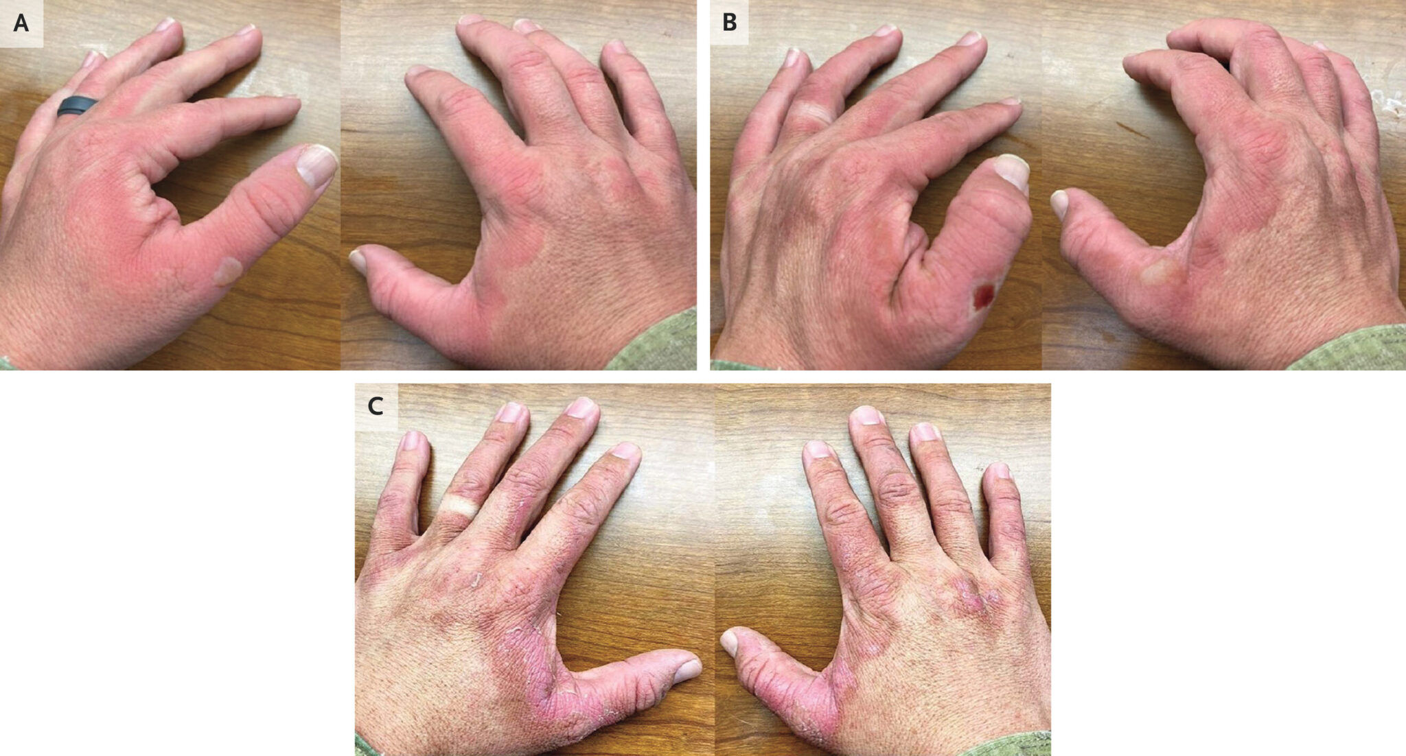 DNA'ya zarar veriyor, iyileşmesi aylar sürüyor! O gıdalara dikkat - 1. Resim