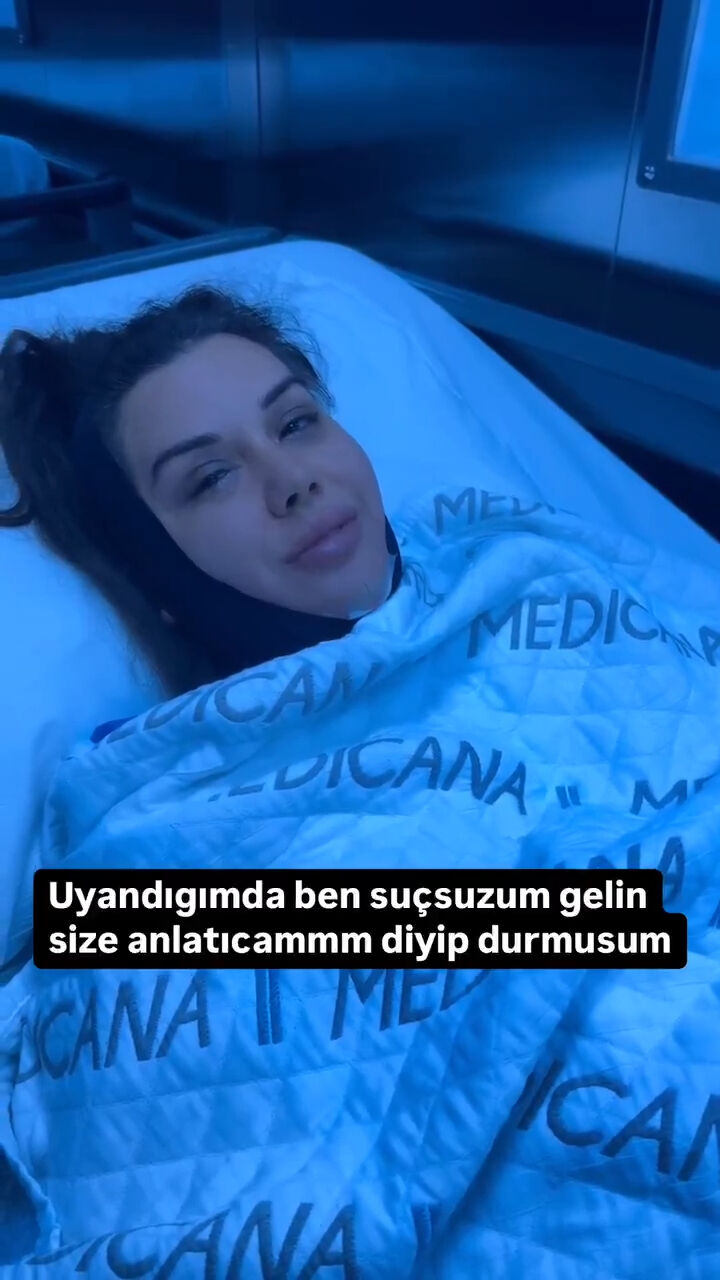 "Geçim sıkıntısı çekiyorum" demişti! Dilan Polat yüz gerdirme ameliyatı oldu! O görüntülere tepki yağdı "Geçim sıkıntısı çekiyorum" demişti! Dilan Polat yüz gerdirme ameliyatı oldu! O görüntülere tepki yağdı - 4. Resim
