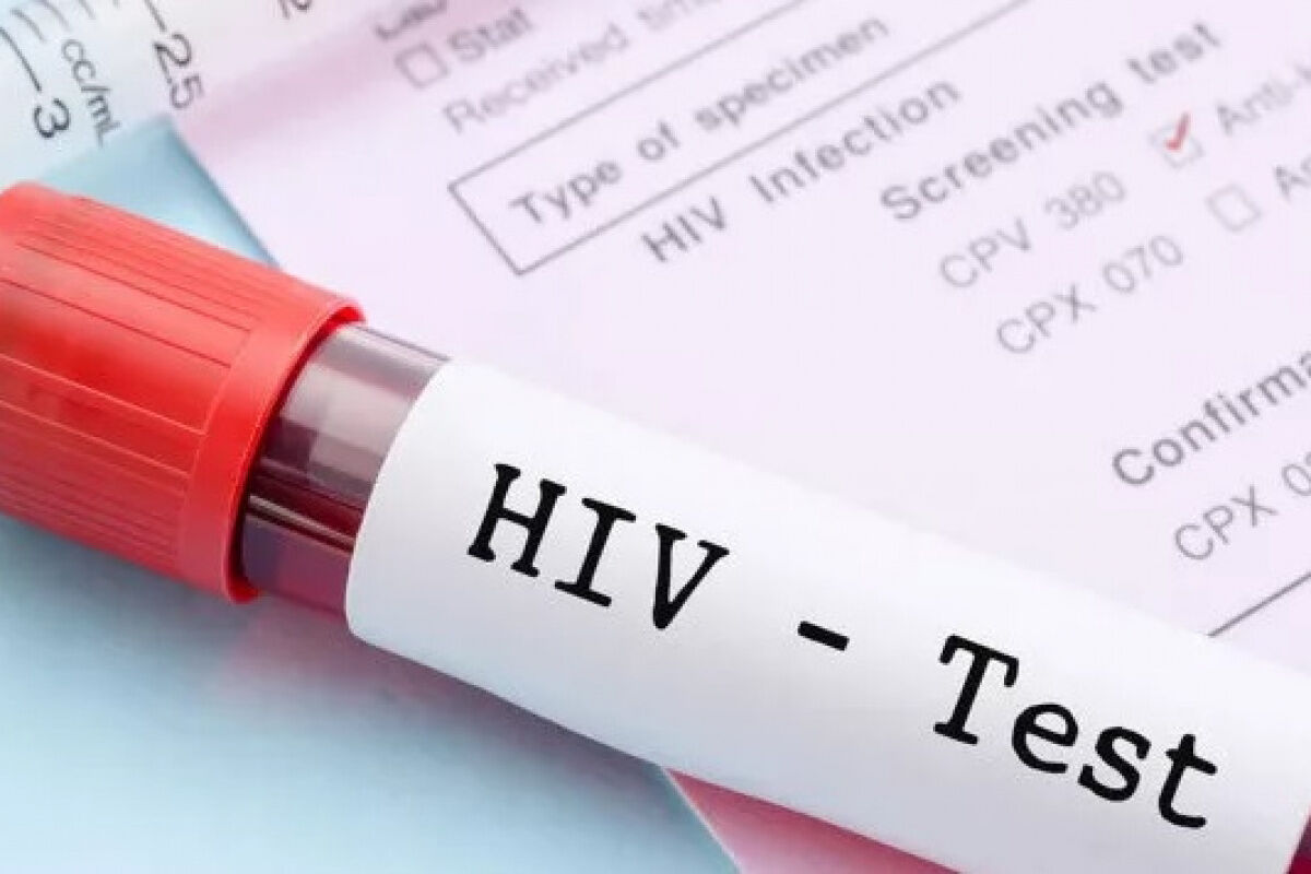 İHA-HIV virüsü hakkında bilinen yanlışlar ve tedavi yolları neler? |  Türkiye Gazetesi