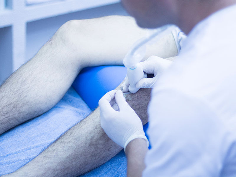 Menisküs ameliyatı kaç ayda iyileşir? Uzmanların görüşleri - 2. Resim