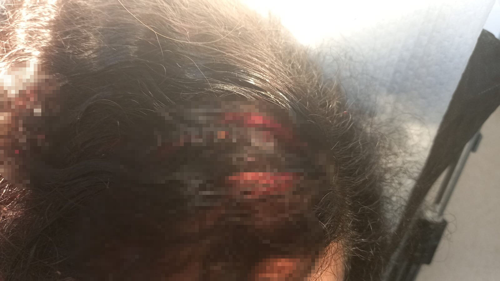 Takıntılı komşusu, Sevda Çiftçi'nin hayatını kararttı! Arkadaşlık istediğini reddedince dehşeti yaşadı Takıntılı komşusu, Sevda Çiftçi'nin hayatını kararttı! Arkadaşlık istediğini reddedince dehşeti yaşadı - 1. Resim