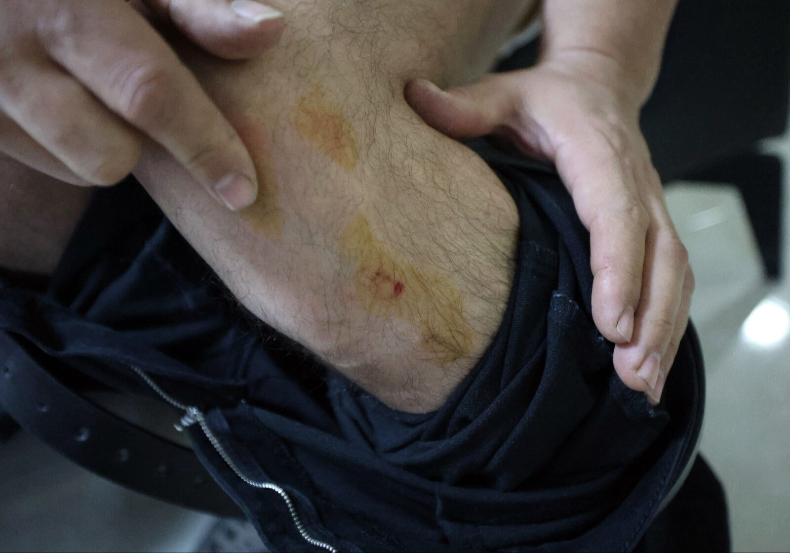 Fabrika işçisine köpek sürüsü saldırdı - 2. Resim