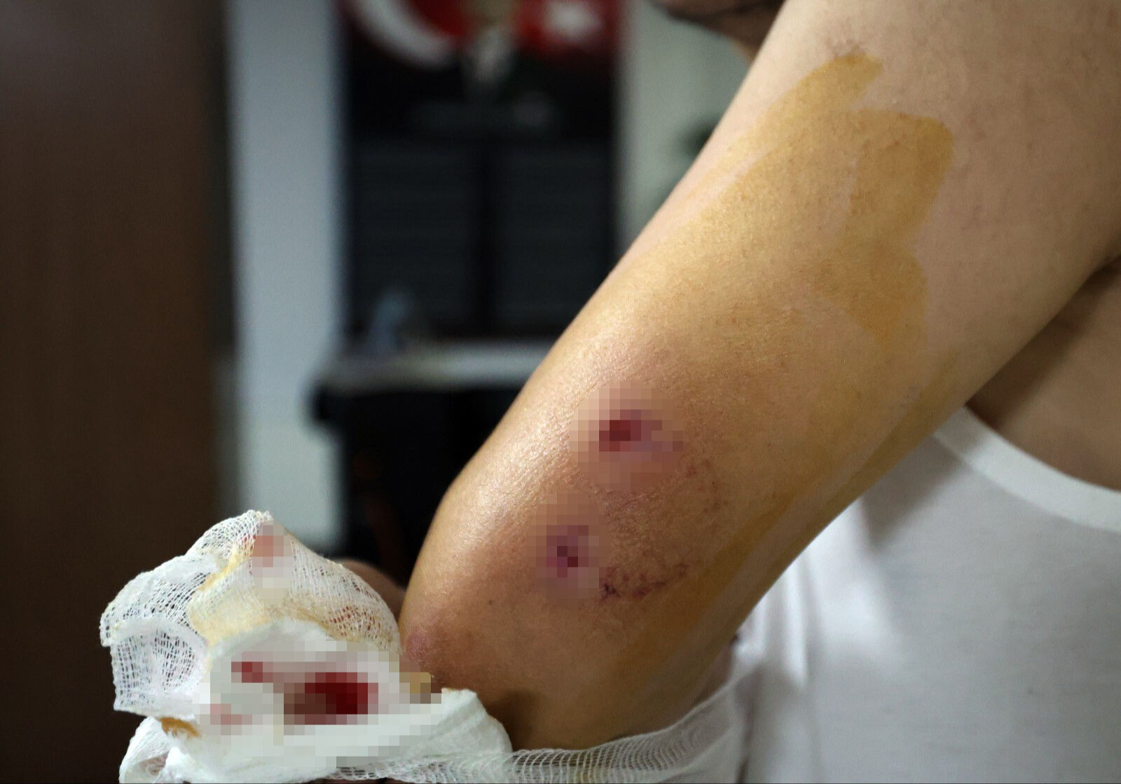 Fabrika işçisine köpek sürüsü saldırdı - 1. Resim