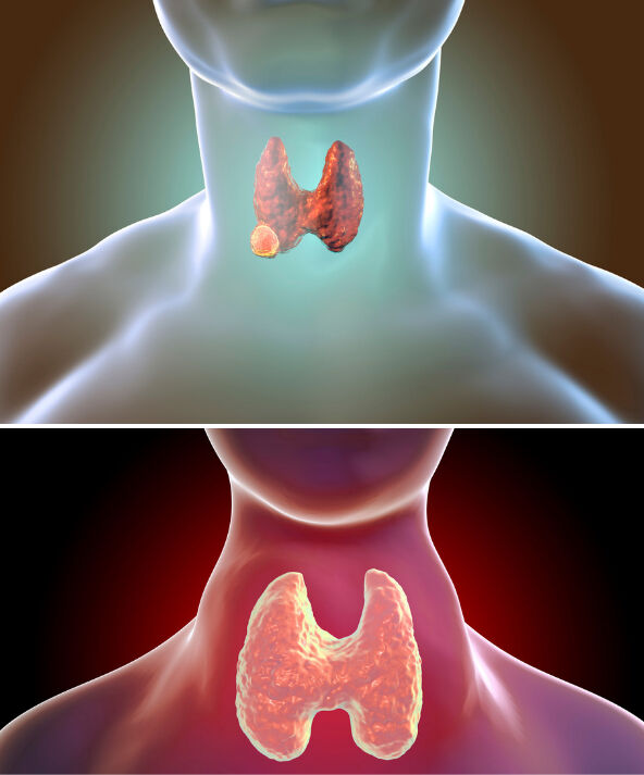 Tiroid nedir ve vücuttaki rolü nelerdir? Tiroid nedir ve vücuttaki rolü nelerdir? - 3. Resim