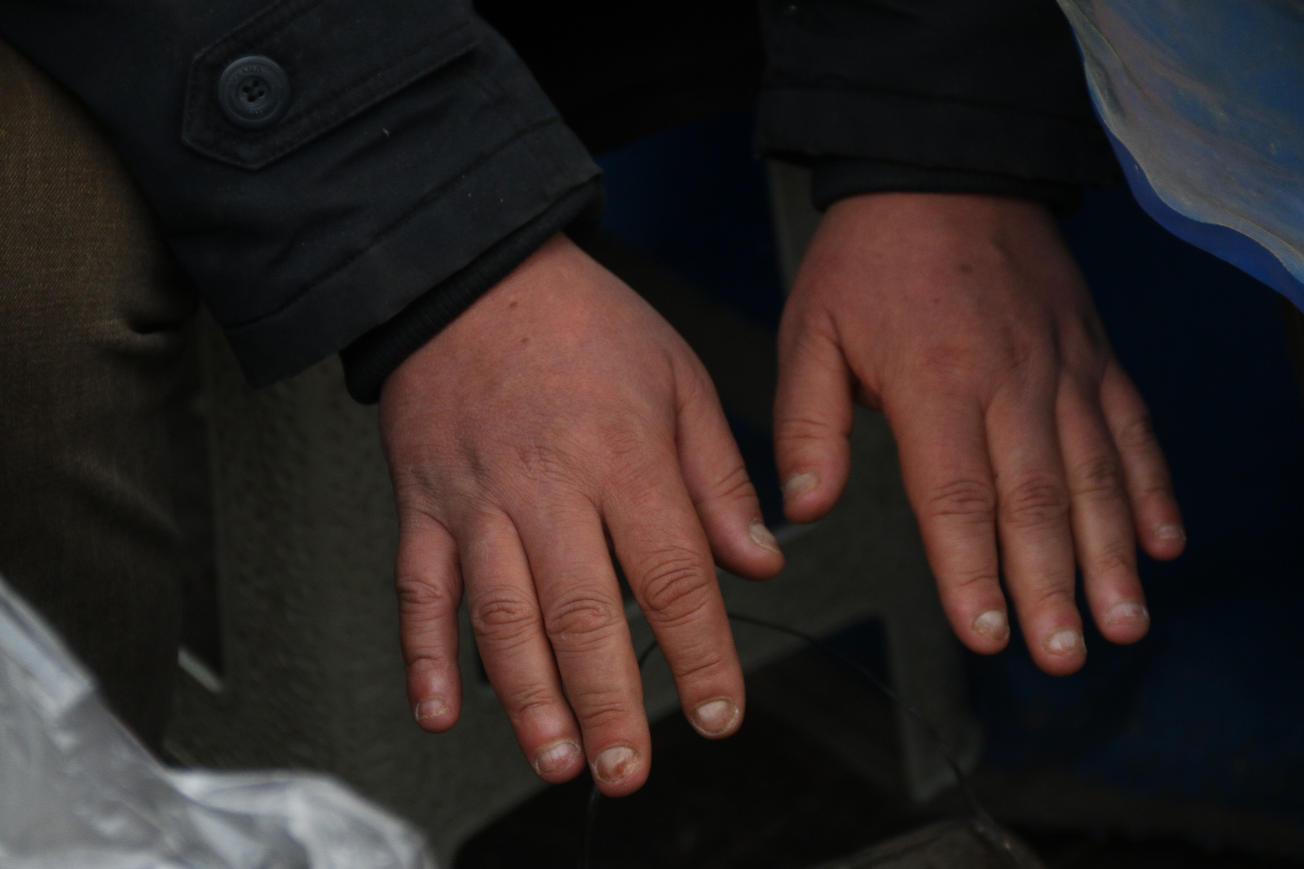 Uzmanlar uyardı! Bunlara dikkat etmelisiniz! İşte kışın cilt sağlığını korumanın püf noktaları... - 3. Resim