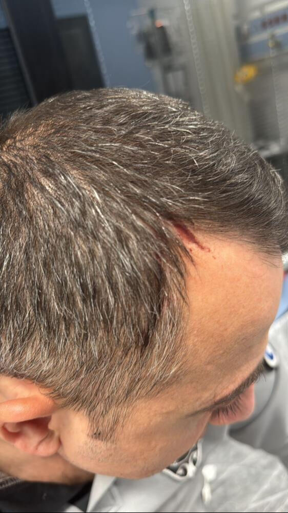 İZBAN'da sigara y&uuml;z&uuml;nden kavga &ccedil;ıktı! 2 g&uuml;venlik g&ouml;revlisi bı&ccedil;aklandı - 2. Resim