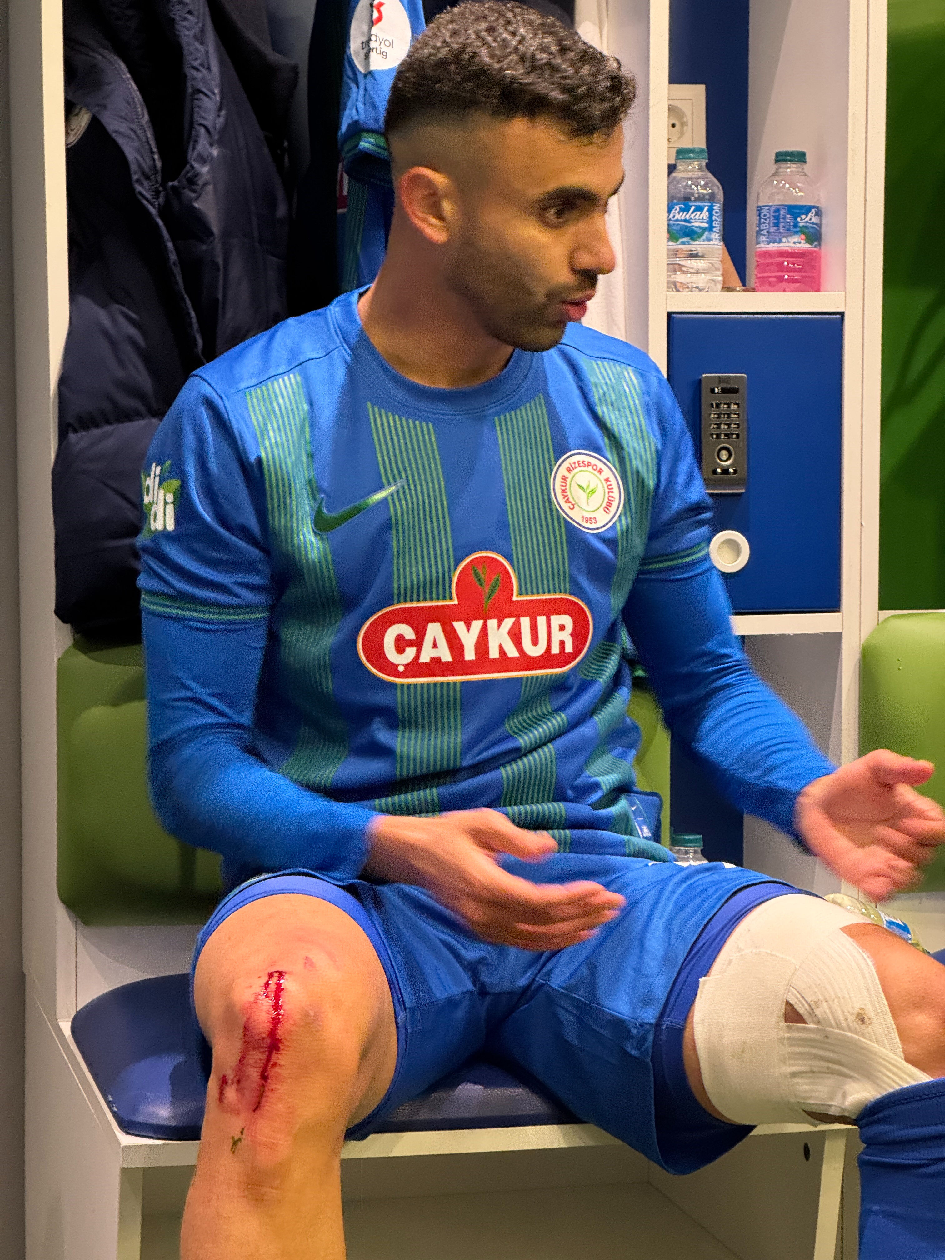 Süper Lig maçında kan aktı! Rize, Rachid Ghezzal'ın soyunma odasındaki fotoğrafını paylaştı - 1. Resim