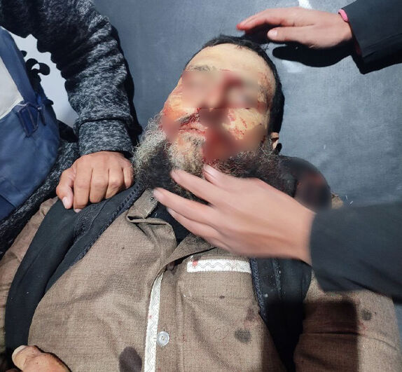 Torunu Rim y&uuml;rekleri dağlamıştı! 