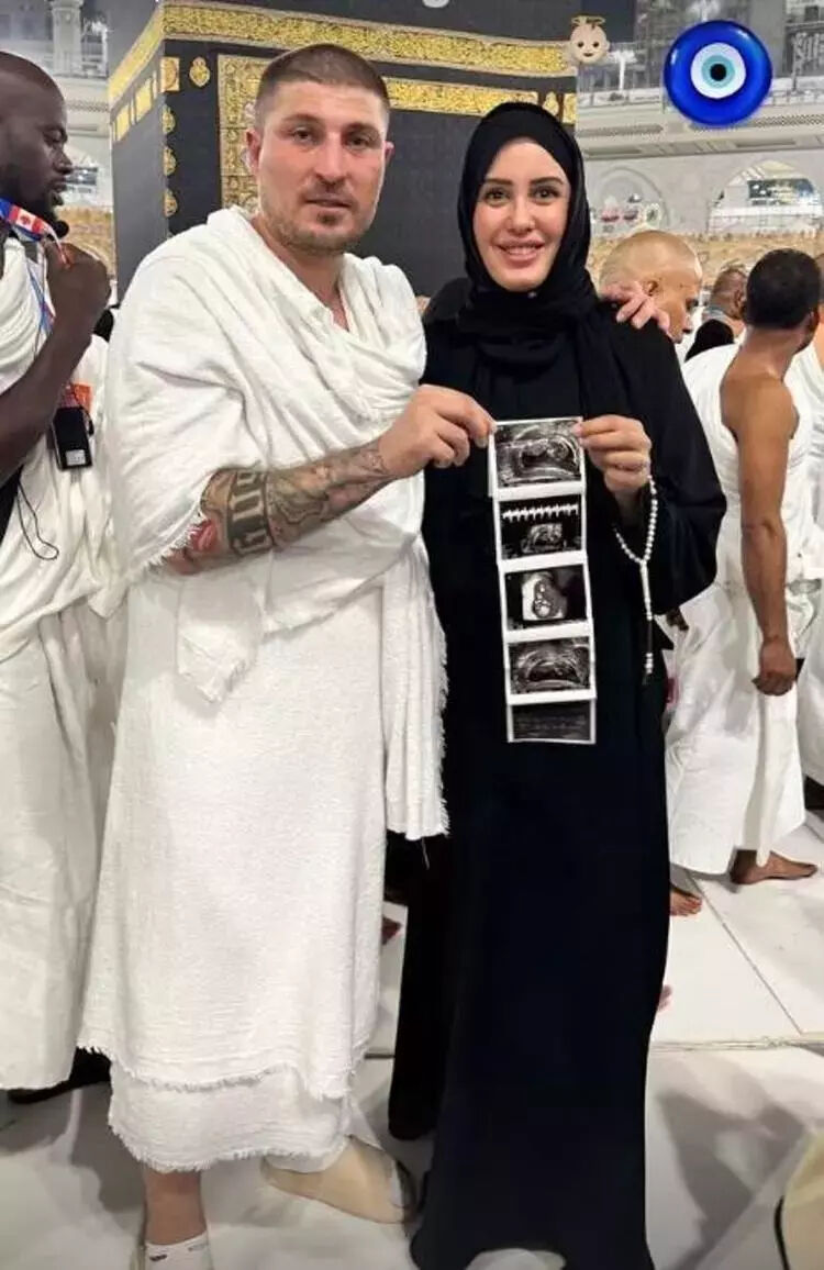 Hamile olan Survivor'ın eski yarışmacısı Sahra Işık trafik kazası geçirdi! Apar topar hastaneye kaldırıldı - 2. Resim