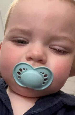 Kreşteki kazada dehşeti yaşadı! 3 yaşındaki çocuk kör oldu Kreşteki kazada dehşeti yaşadı! 3 yaşındaki çocuk kör oldu - 1. Resim