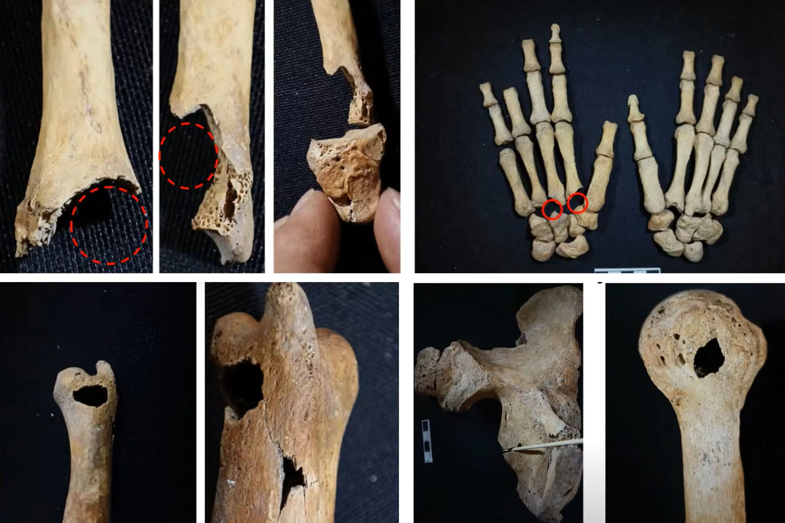 İznik kazıları yamyamlık ve işkenceyi ispatladı! Haçlıların Anadolu’daki vahşeti gün yüzüne çıktı - 2. Resim