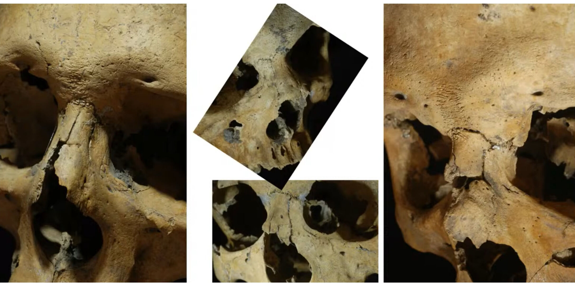 İznik kazıları yamyamlık ve işkenceyi ispatladı! Haçlıların Anadolu’daki vahşeti gün yüzüne çıktı - 10. Resim