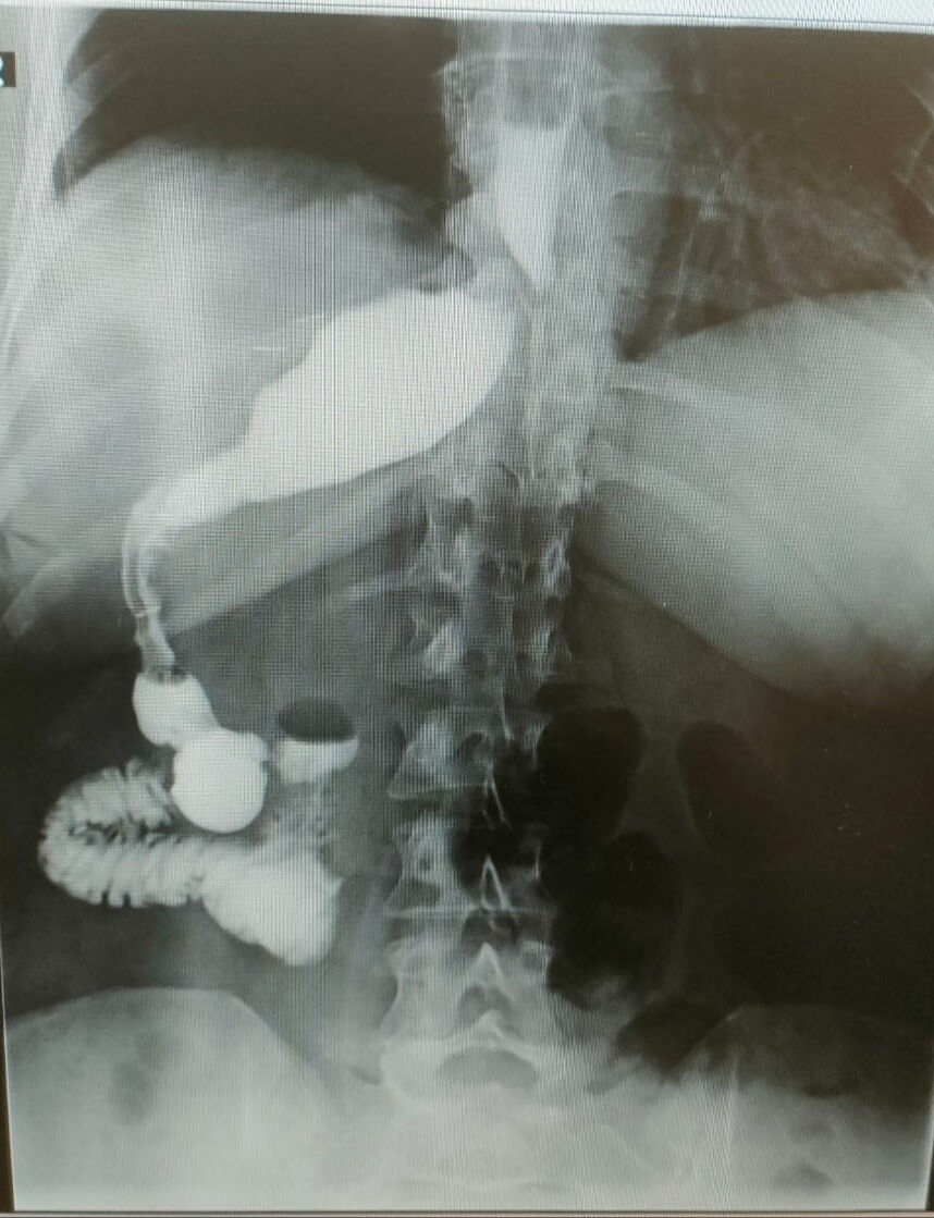 Zayıflamak için gittiği doktorda hayatının şokunun yaşadı! 