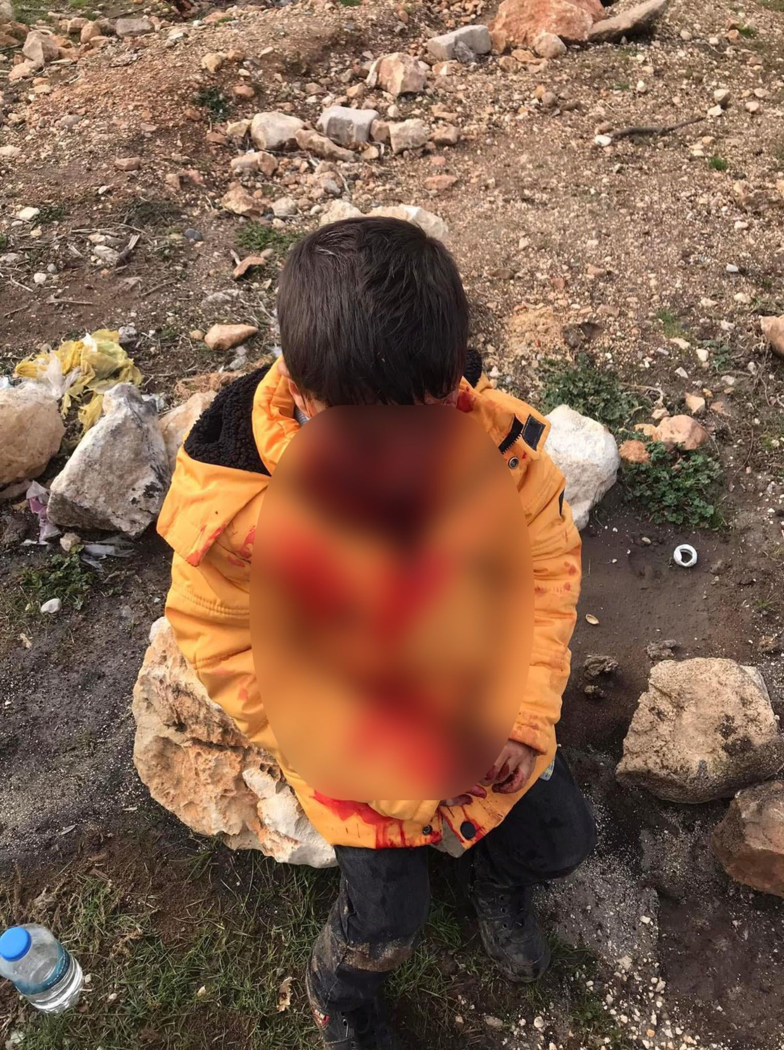 Başıboş köpek saldırısı! Küçük çocuk ağır yaralandı, acil ameliyata alındı - 1. Resim