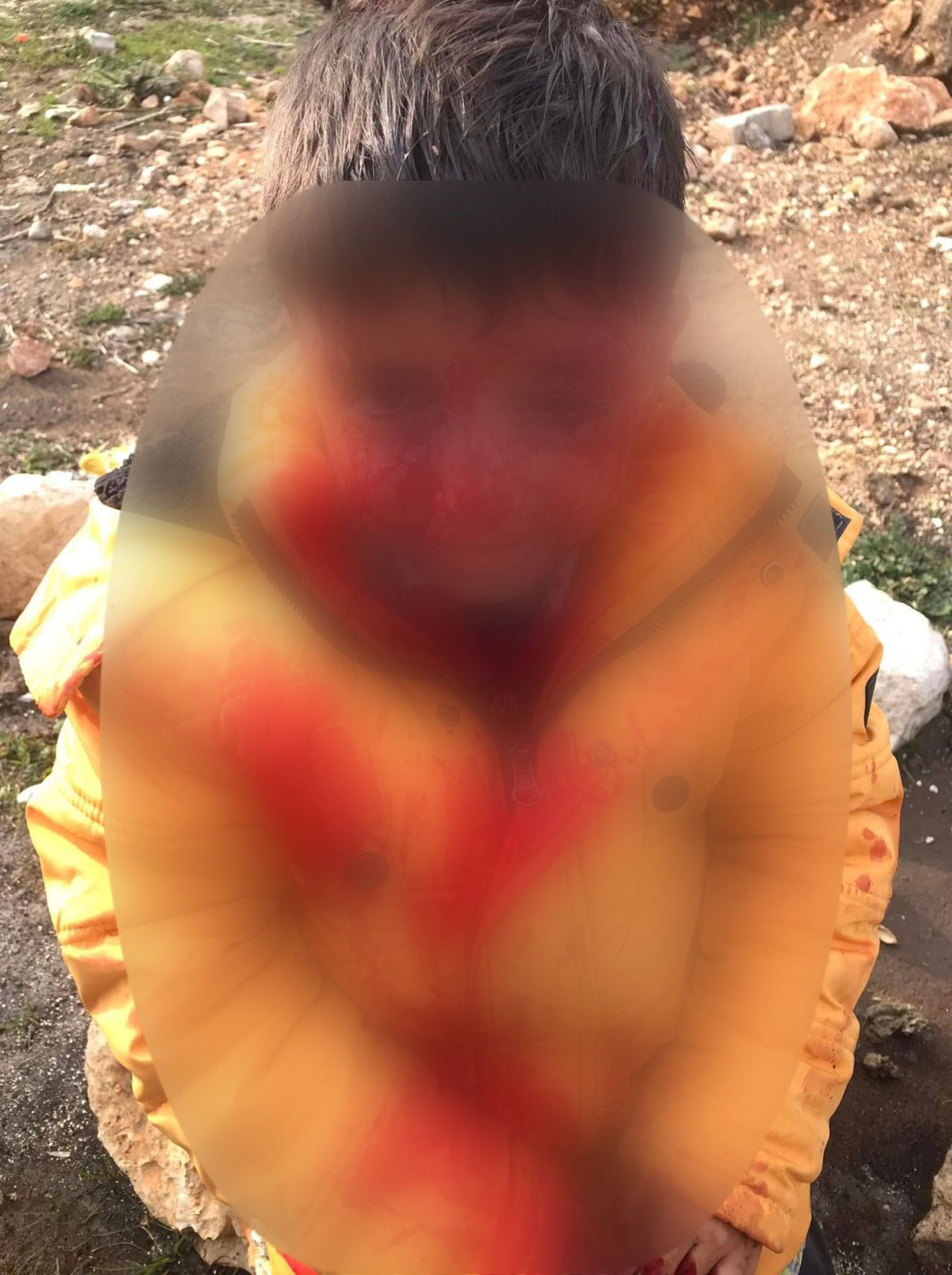 Başıboş köpek saldırısı! Küçük çocuk ağır yaralandı, acil ameliyata alındı - 2. Resim