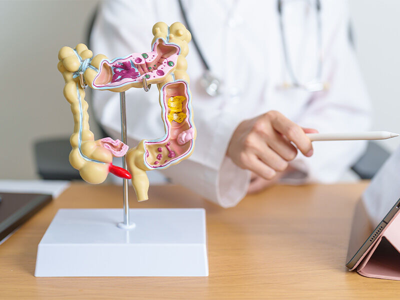 Bağırsak kanseri belirtileri nelerdir? Türkiye'de en yaygın üçüncü tür  hakkında bilmeniz gerekenler | Türkiye Gazetesi