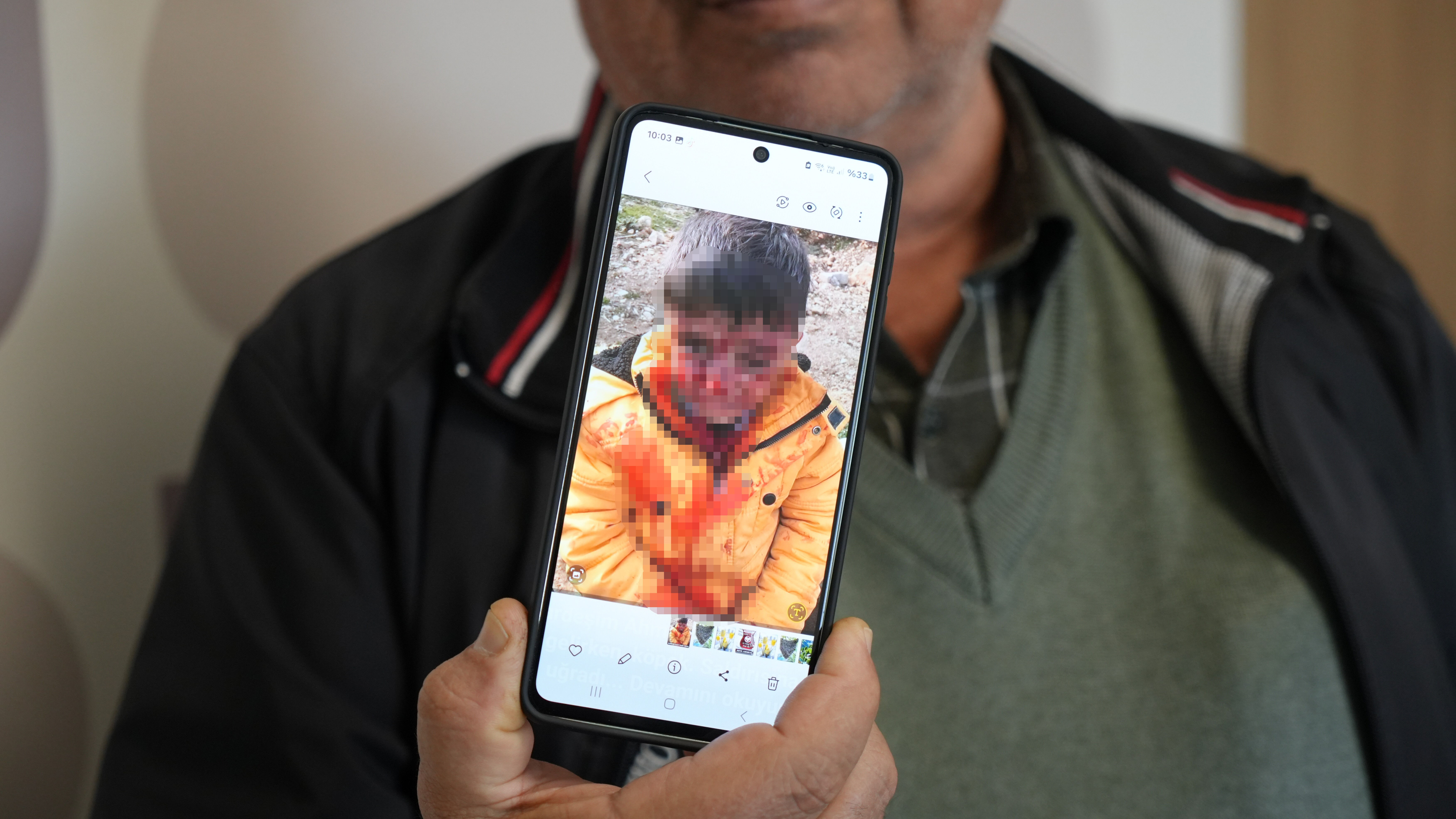 Çocuğa saldıran hayvanlar kuduz çıktı! Ne köpekler toplanıyor ne vakalar azalıyor - 2. Resim