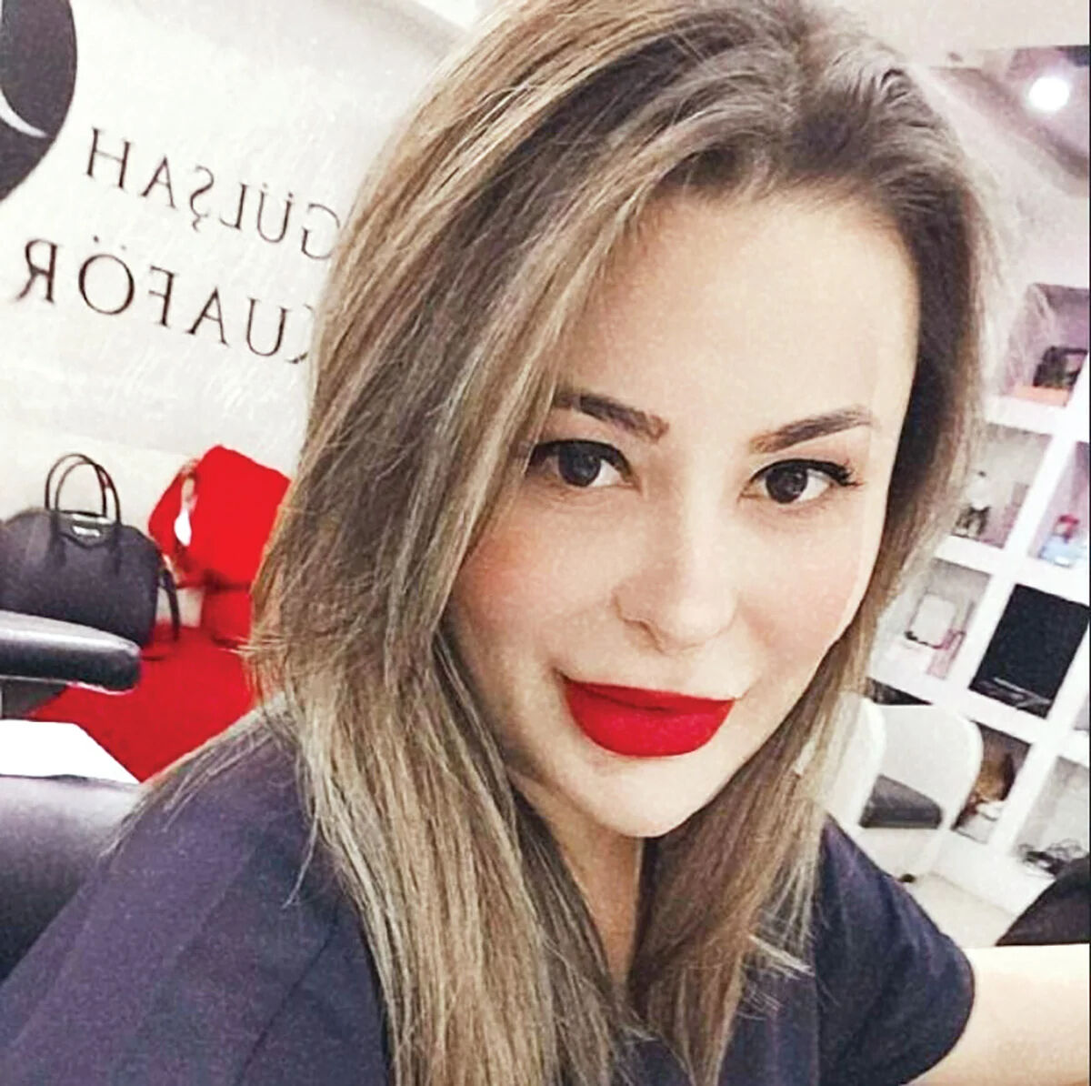 Estetikte bir skandal daha! Fenomen Neşe Özkan'ın ölümünün ardından ortaya çıktı - 2. Resim