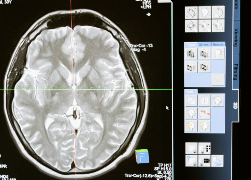 Hayatını kabusa çeviren hastalık ‘delirten ağrı'dan 4 yıl sonra kurtulabildi - 1. Resim