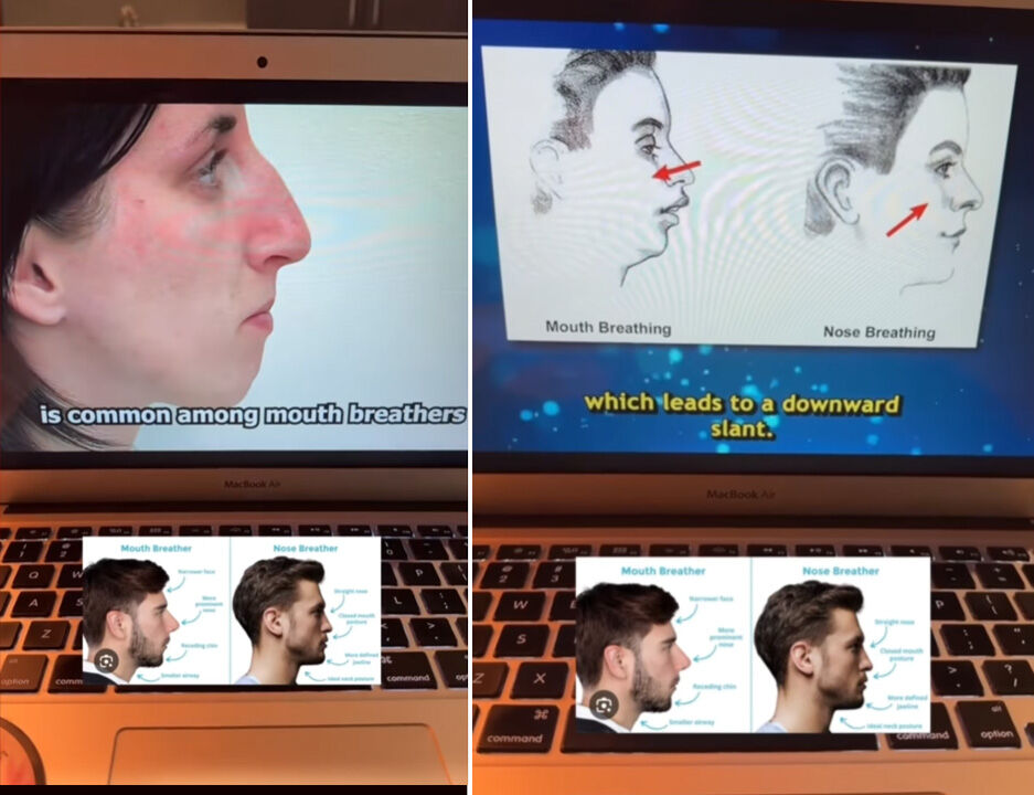 'İngilizler neden çirkin?' Nörobilimcinin analizi viral oldu: Ameliyatsız estetik mümkün! - 1. Resim