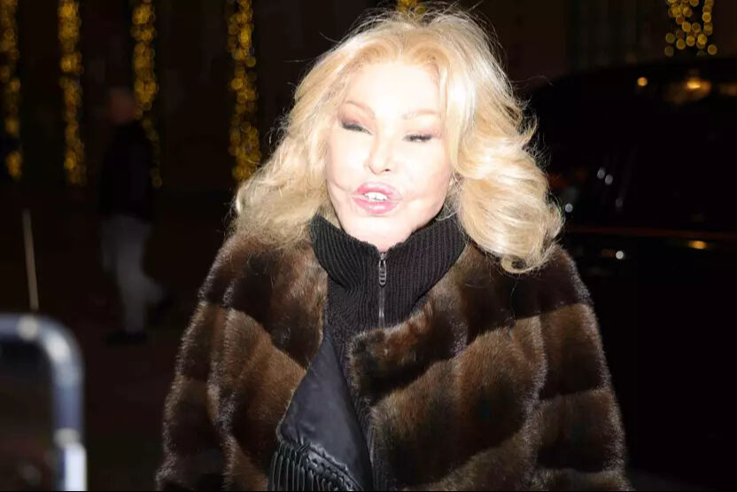 'Kedi Kadın' olarak biliniyordu! Jocelyn Wildenstein 84 yaşında hayatını kaybetti! Ölüm sebebi belli oldu 'Kedi Kadın' olarak biliniyordu! Jocelyn Wildenstein 84 yaşında hayatını kaybetti Ölüm sebebi belli oldu - 2. Resim