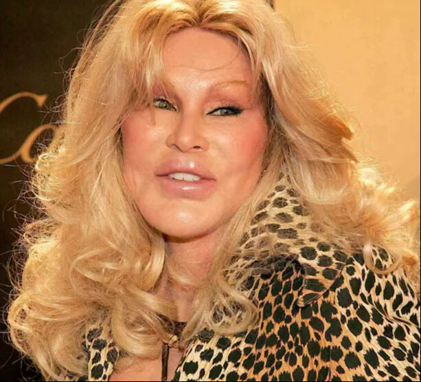 'Kedi Kadın' olarak biliniyordu! Jocelyn Wildenstein 84 yaşında hayatını kaybetti! Ölüm sebebi belli oldu 'Kedi Kadın' olarak biliniyordu! Jocelyn Wildenstein 84 yaşında hayatını kaybetti Ölüm sebebi belli oldu - 1. Resim