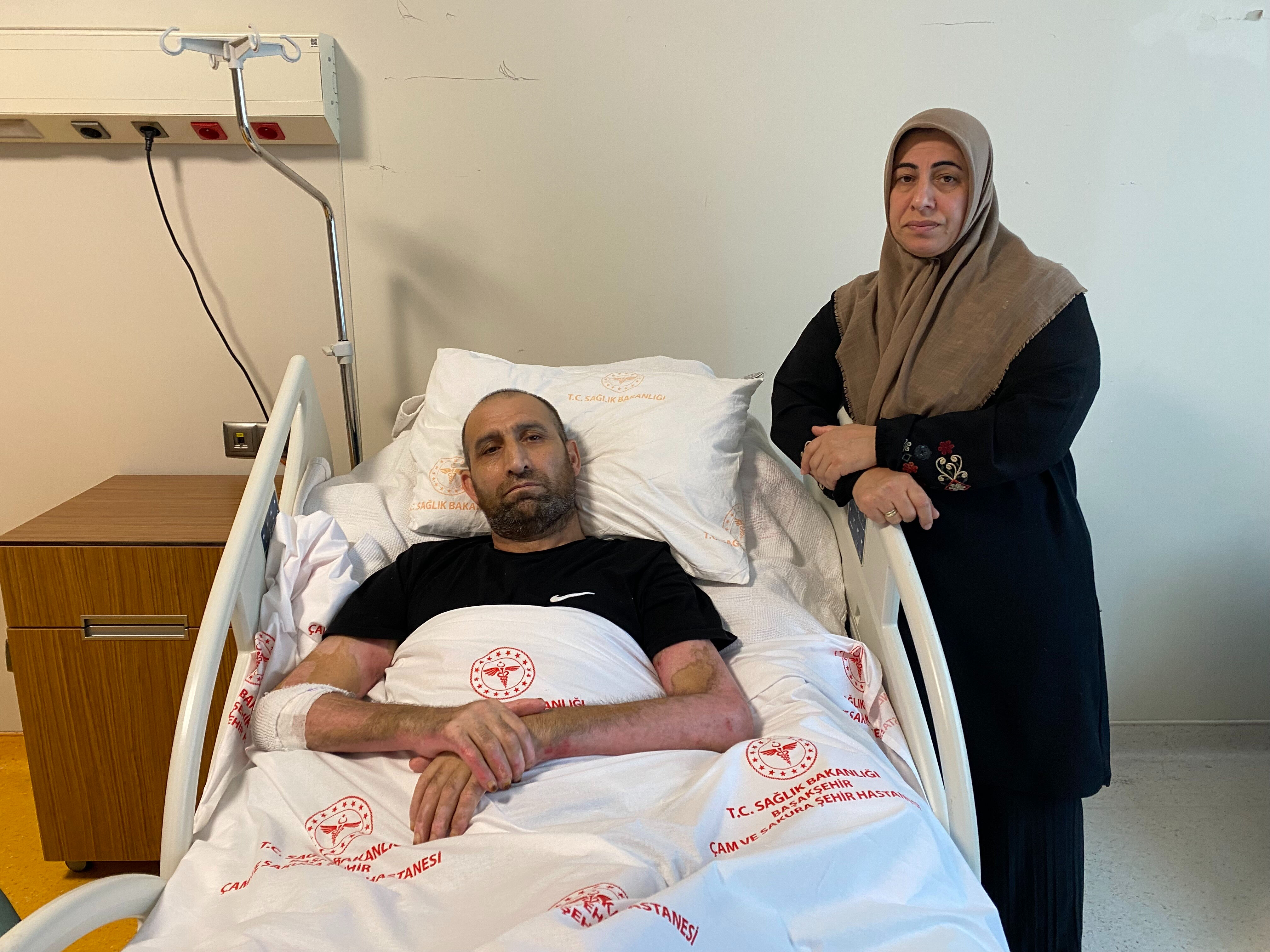 Patlama yeri göğü inletti! Saniyeler içinde vücudunun yüzde 80'i yandı: Bunu yaparken dikkat edin - 1. Resim