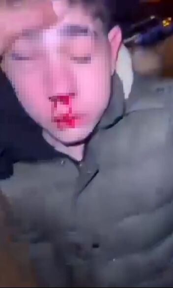 Esenyurt'ta sağır ve dilsiz çocuğa işkence yapan caniler yakalandı! Görüntüler yürekleri parçaladı Esenyurt'ta sağır ve dilsiz çocuğa işkence yapan caniler yakalandı! Görüntüler yürekleri parçaladı - 3. Resim