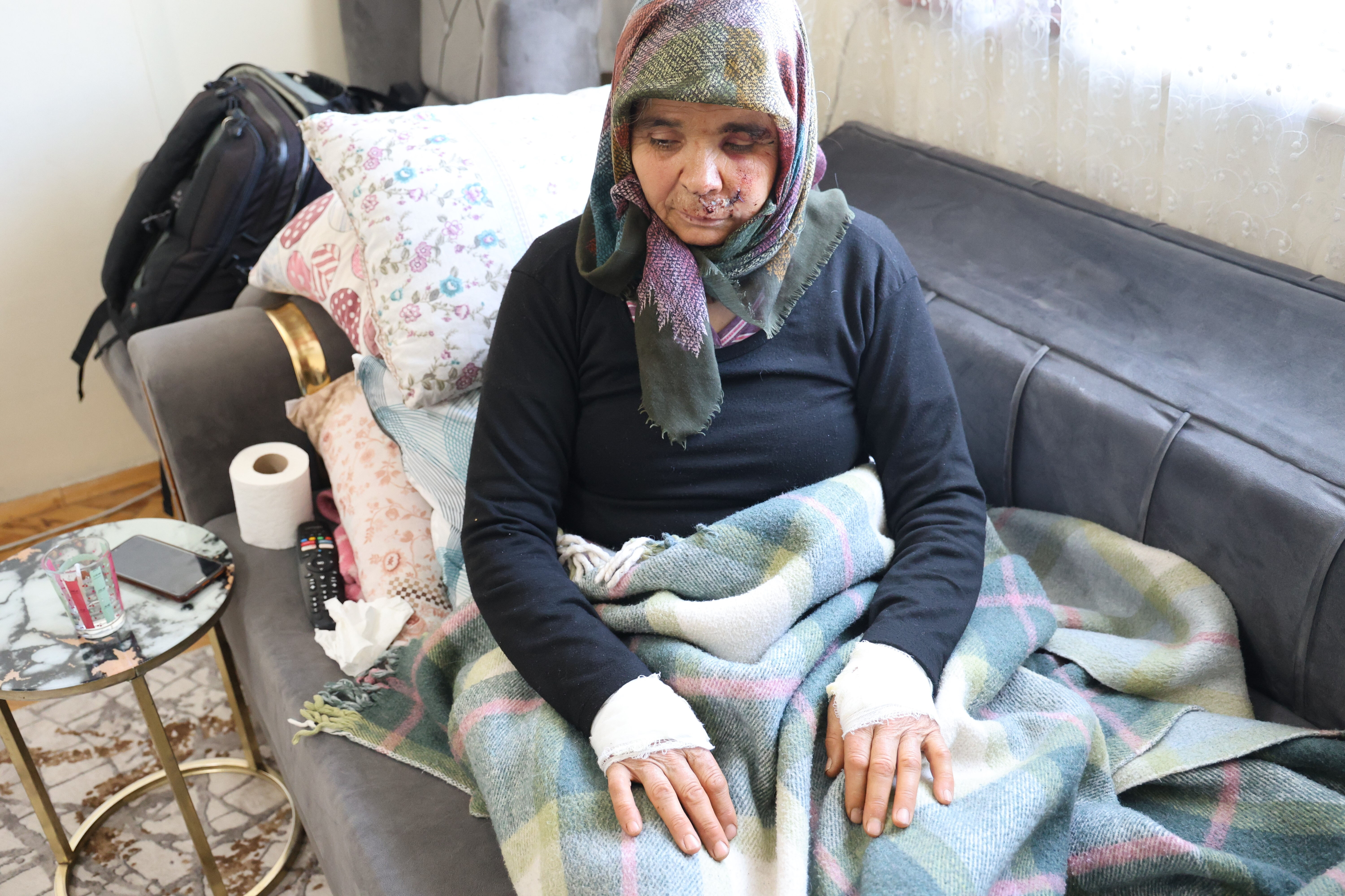 Her gün bir saldırı haberi geliyor, belediyeler köpek terörünü izliyor! Her gün bir saldırı haberi geliyor, belediyeler köpek terörünü izliyor! - 4. Resim