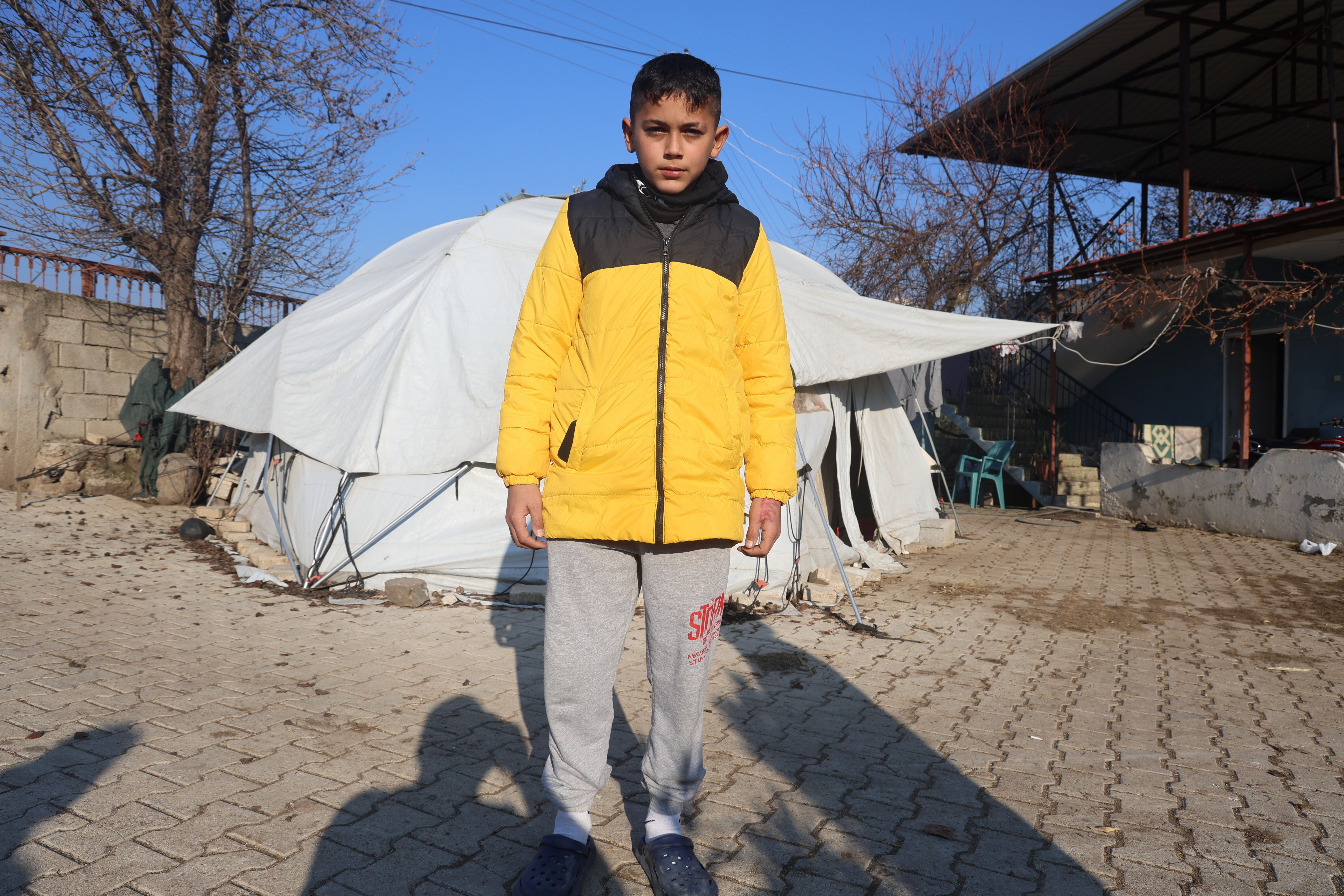 Kuduz köpek ısırmıştı! 10 yaşındaki Murat dehşet anlarını böyle anlattı - 1. Resim